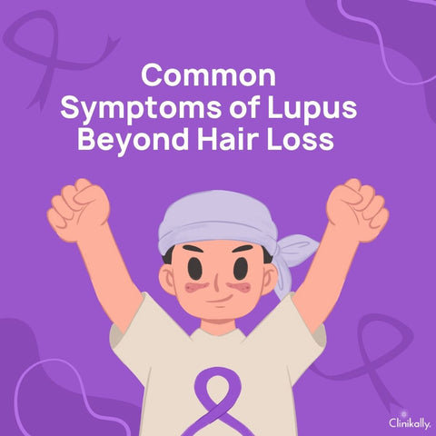 Common Symptoms of Lupus Beyond Hair Loss