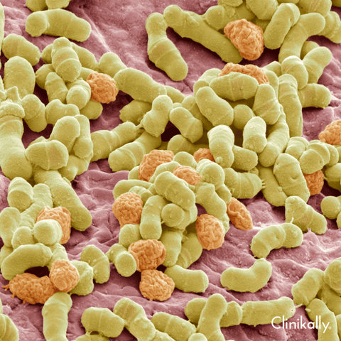 Understanding Malassezia