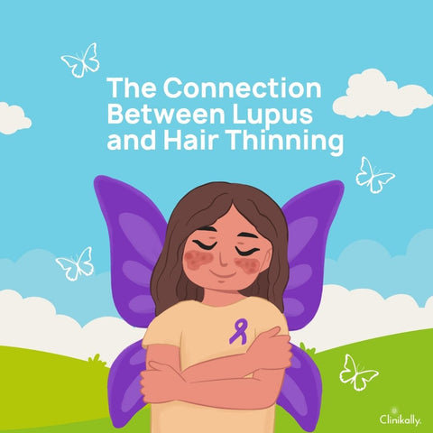 The Connection Between Lupus and Hair Thinning