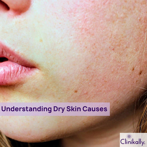 Understanding Dry Skin Causes