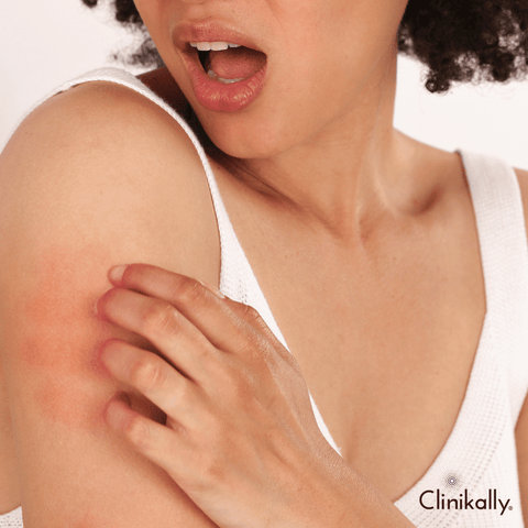 Recognising signs of Salicylic acid overuse