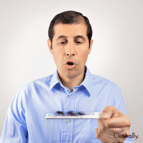 Side effects of Minoxidil