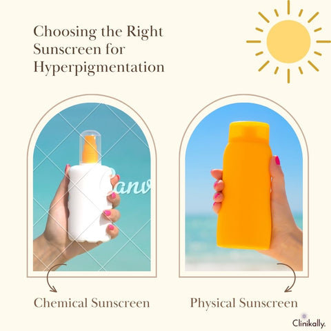 Choosing the Right Sunscreen for Hyperpigmentation