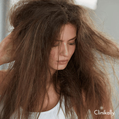 Mineral Build-up and Scalp Irritation: The Negative Effects of Hard Water on Hair