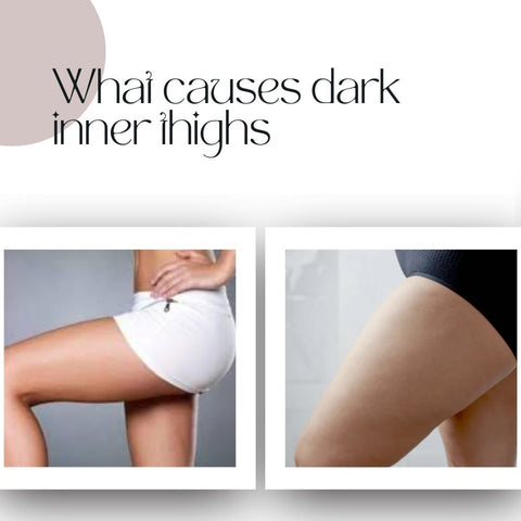 What causes dark inner thighs