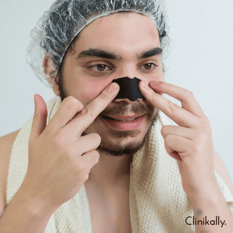 Whiteheads on nose