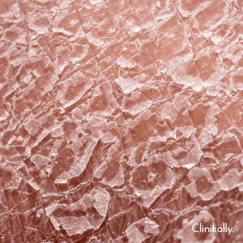 5 signs of skin barrier damage