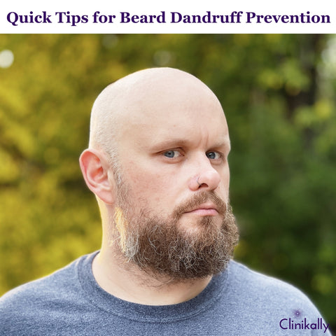 Tips to Prevent Beard Dandruff