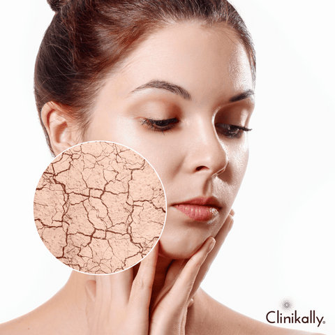 The impact of pollution on skin barrier