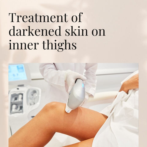 Treatment of darkened skin on inner thighs