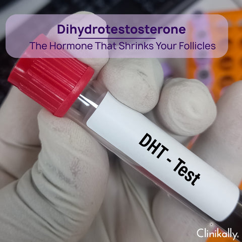 The Role of Dihydrotestosterone
