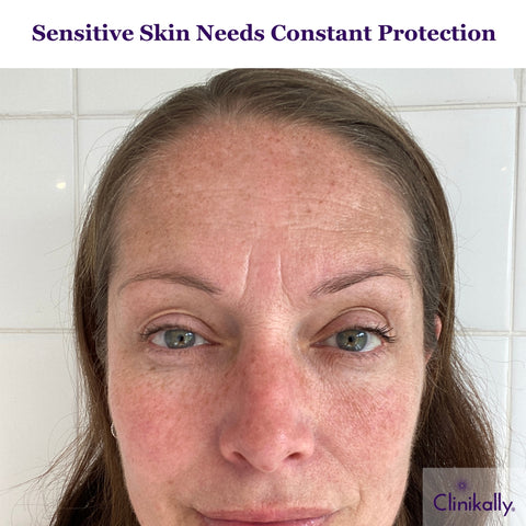 The Necessity of Constant Protection