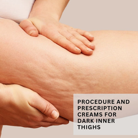 Procedure and prescription creams for dark inner thighs
