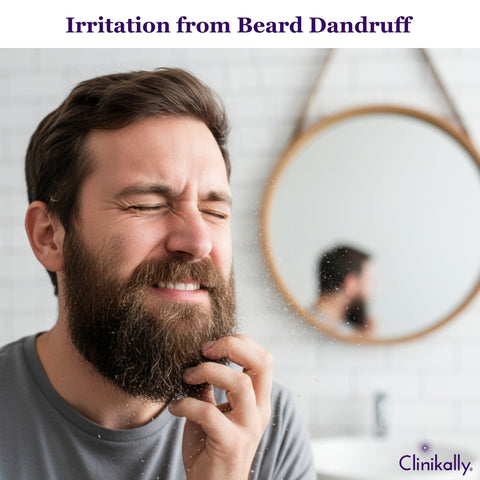 Irritation and Inflammation from Beard Dandruff