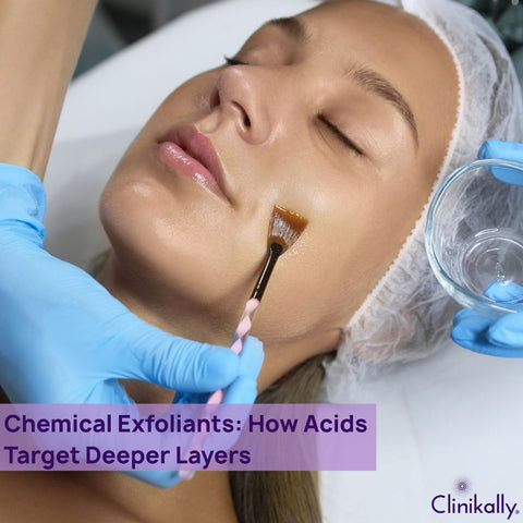Chemical Exfoliants: How Acids Target Deeper Layers