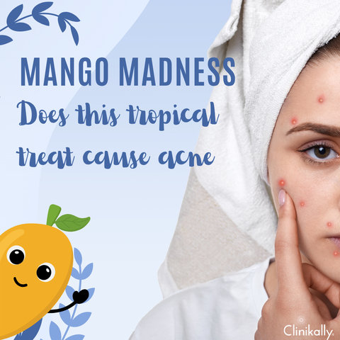 Mango Madness: Does This Tropical Treat Cause Acne?