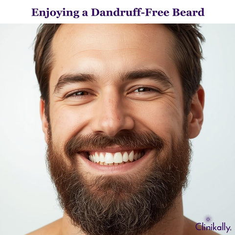 Enjoying the Benefits of a Dandruff-Free Beard