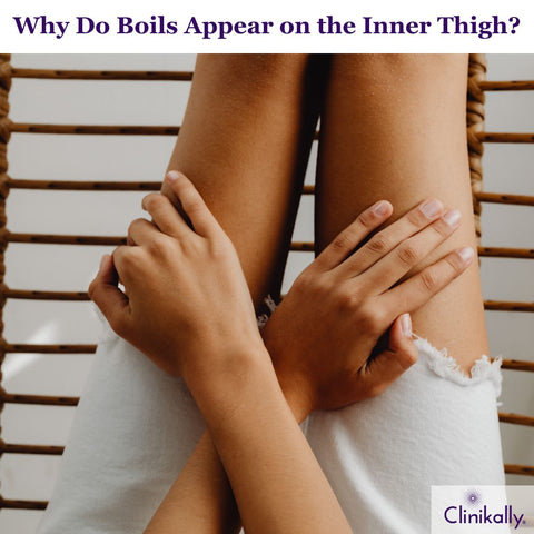 Finding the Causes of Inner Thigh Boils
