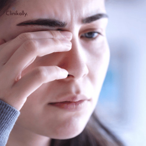 Common Causes of Tired-Looking Eyes