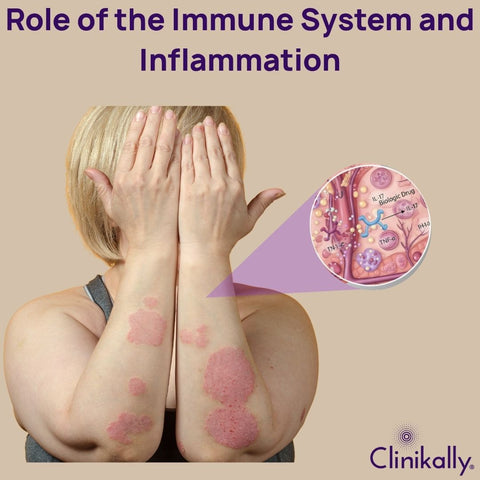 Role of the Immune System and Inflammation
