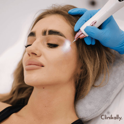 Professional collagen-stimulating procedures