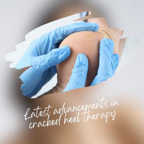 Latest advancements in cracked heel therapy