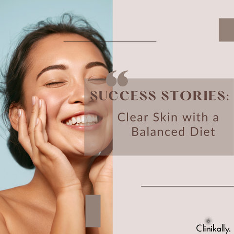 Success Stories: Clear Skin with a Balanced Diet