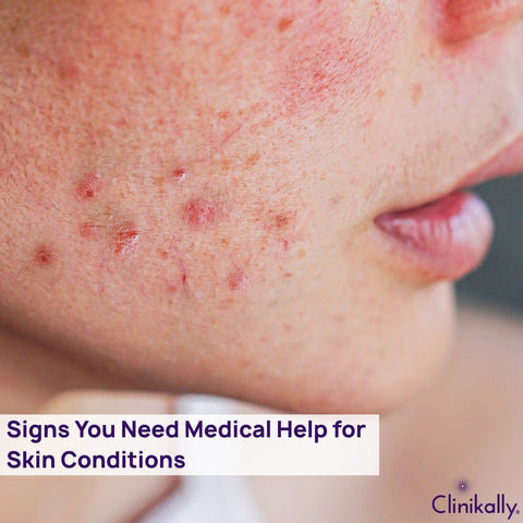 While many skin conditions may be treated