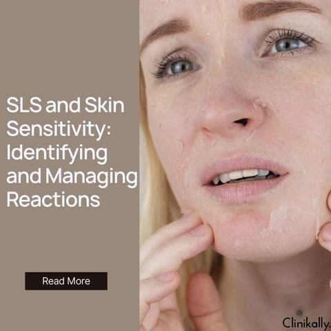 SLS and Skin Sensitivity: Identifying and Managing Reactions