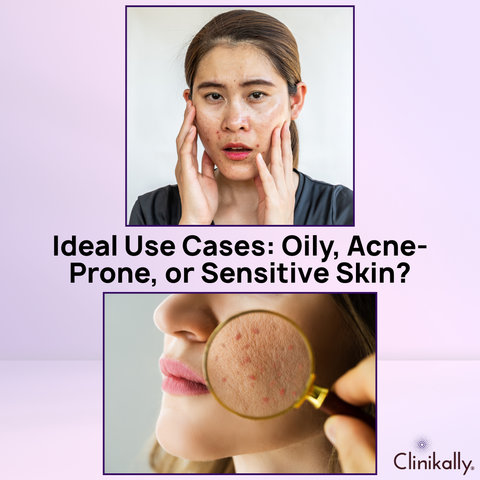 Ideal Use Cases: Oily, Acne-Prone, or Sensitive Skin?