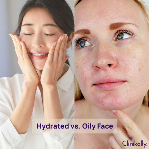 Hydrated vs. Oily: How to Spot the Subtle Differences