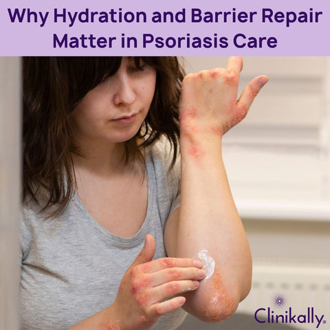 Why Hydration and Barrier Repair Matter in Psoriasis Care