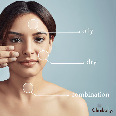 Understanding Your Skin Type and Concerns