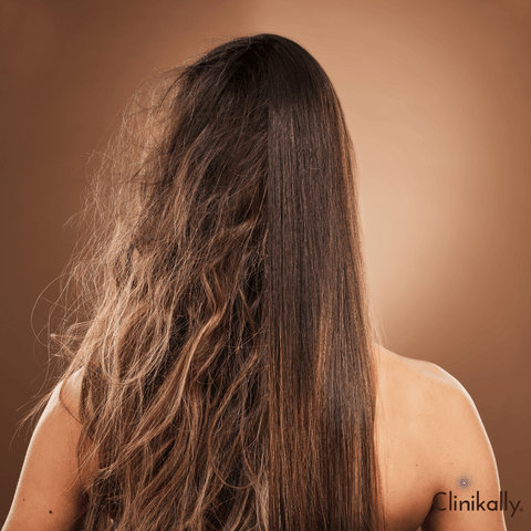 The relationship between hair type and split ends
