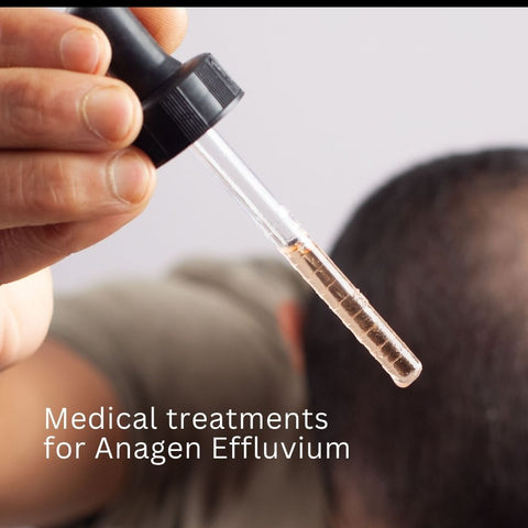 Medical treatments for Anagen Effluvium