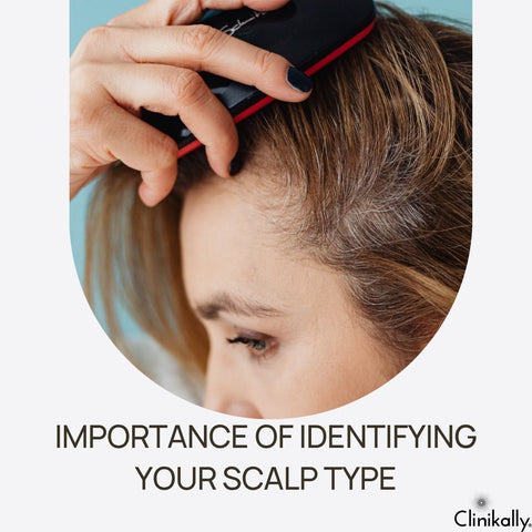 Importance of Identifying Your Scalp Type
