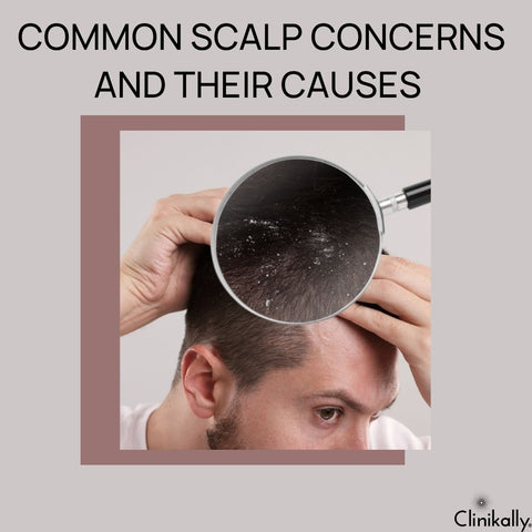 Common Scalp Concerns and Their Causes