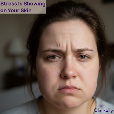 Stress Is Showing on Your Skin