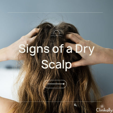 Signs of a Dry Scalp