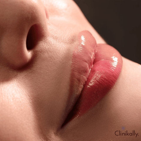 Protecting Your Lips from Sun Damage with a Lip-wash