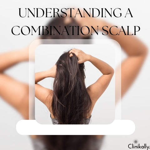 Understanding a Combination Scalp