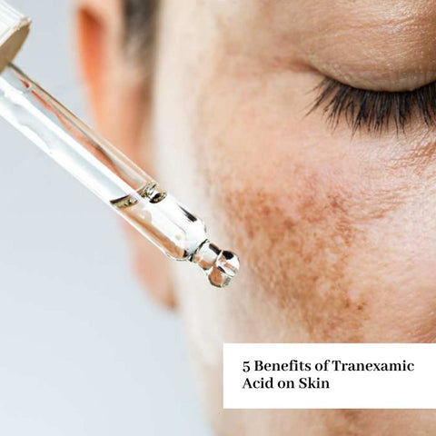 5 Benefits of Tranexamic Acid on Skin