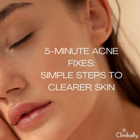 5-Minute Acne Fixes: Simple Steps to Clearer Skin