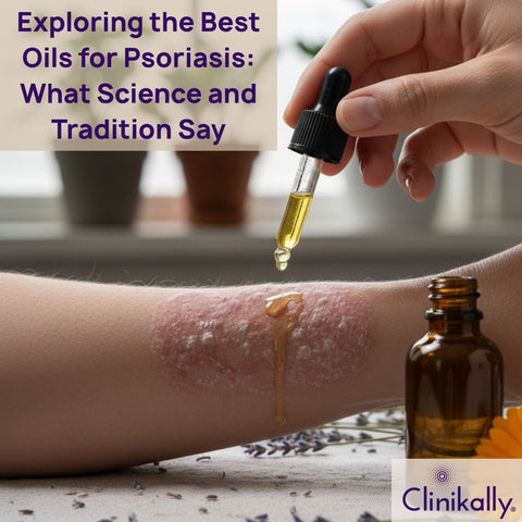 what are the Best Oils for Psoriasis