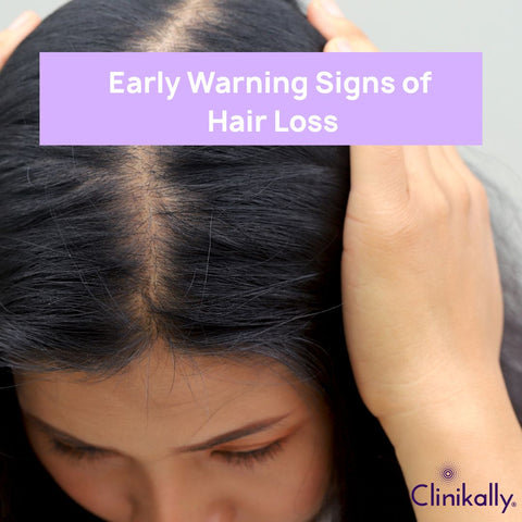 Early Warning Signs of Hair Loss