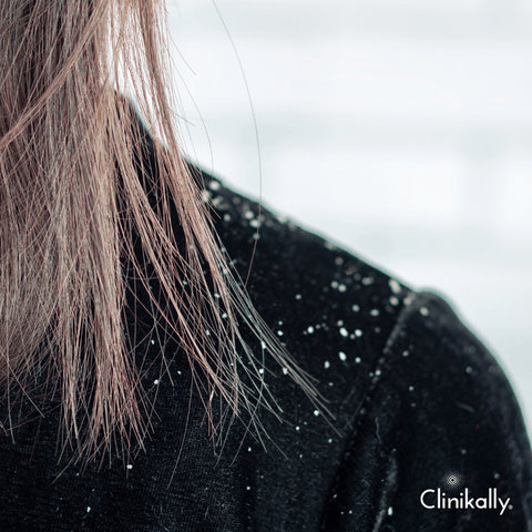 Fighting Dandruff