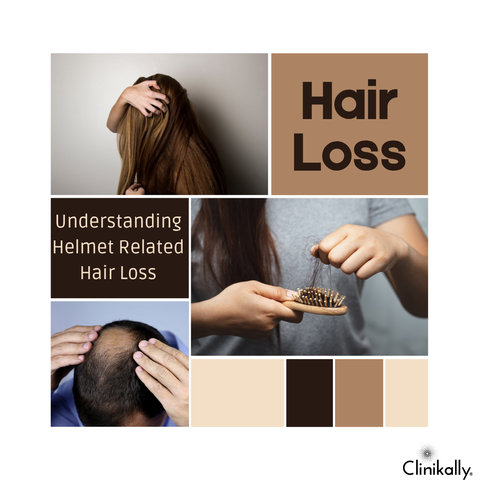 Understanding Helmet-Related Hair Loss: The Facts and Myths