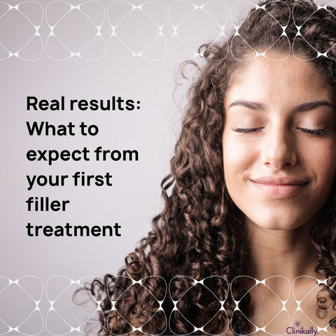 Real results: What to expect from your first filler treatment