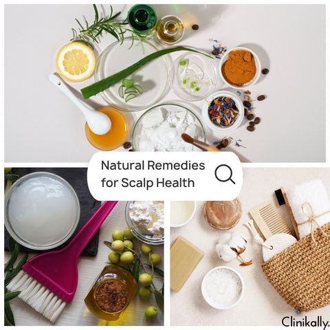 Natural Remedies for Scalp Health