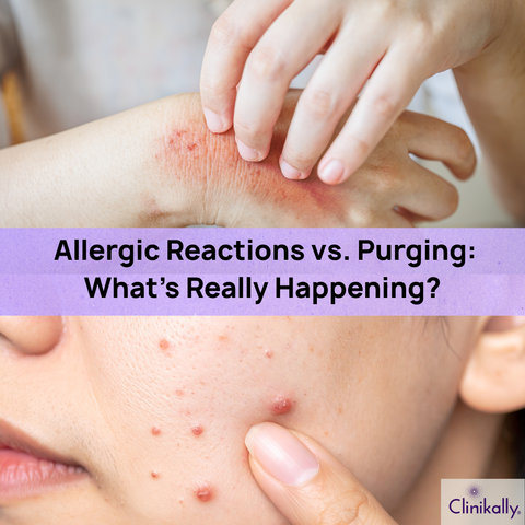 Allergic Reactions vs. Purging: What’s Really Happening?